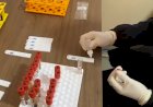 Goiás registra mais de 3 mil casos de coronavírus em 24 horas por três dias seguidos, diz governo