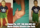Solidariedade: Mãe pede ajuda para cirurgia do filho que possui doença congênita no pé