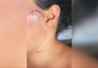 Em Uruana, Cabeleireira é atingida por 5 facadas, após o fim do relacionamento