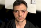 Médico é agredido com socos por marido de paciente que morreu em UPA de Goiás, diz polícia