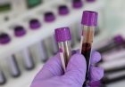 Cientistas desenvolvem exame de sangue inovador para identificar esquizofrenia