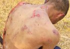Em Goiás: ''Pena máxima e indenização'', diz advogado da família de homem que teve corpo queimado