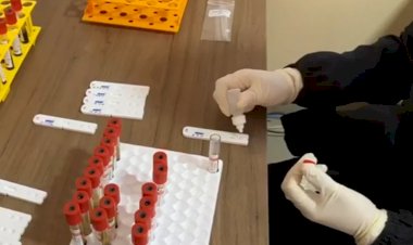 Goiás registra mais de 3 mil casos de coronavírus em 24 horas por três dias seguidos, diz governo