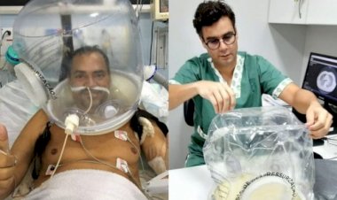 Capacetes evitam a intubação e salvam vidas em UTI da Santa Casa