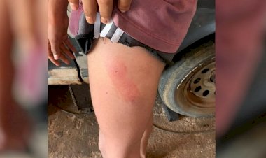 Em Goiás: Menino agredido pelo pai por ser gay pediu ajuda por carta aos vizinhos