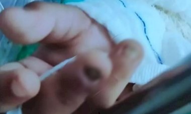 Em Goiás: Menina é internada sem unhas e com lesões no intestino; mãe alega queda de bicicleta
