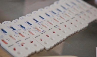Brasil registra 37,9 mil novos casos de covid-19 e mais 1,4 mil mortes