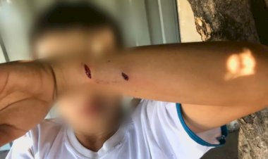 Em Goiás: Menino é atacado por cachorro que passeava com a dona em rua