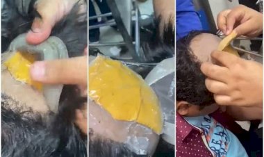 Homem é flagrado com ouro debaixo da peruca e no reto, em aeroporto na Índia