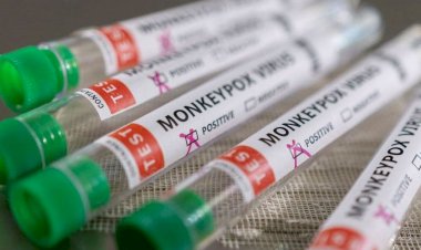 Varíola dos macacos: após confirmação do 1º caso no Brasil, Anvisa faz orientações