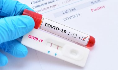 Brasil registra mais de 70 mil casos e 339 mortes por Covid-19 em 24 horas