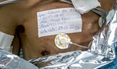 Em Rialma: Dado como morto em hospital, homem fica 5h em saco de cadáver e chega vivo a funerária