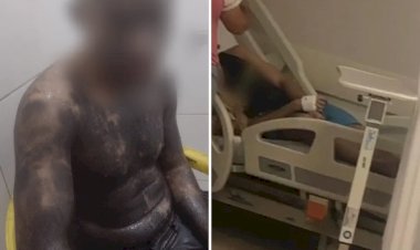 Estudante é levado a hospital após ser deixado desacordado e coberto de tinta em trote universitário, diz mãe