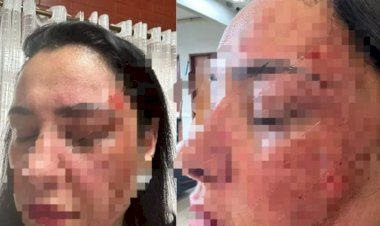 Diretora de Escola Municipal leva pedrada no rosto ao abrir colégio