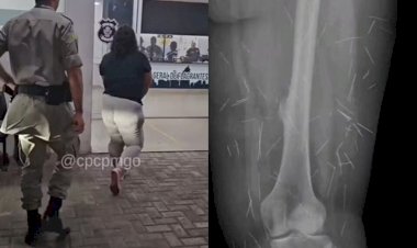 Em Goiás: Mulher com 200 agulhas no corpo fingia ser criança para aplicar golpes