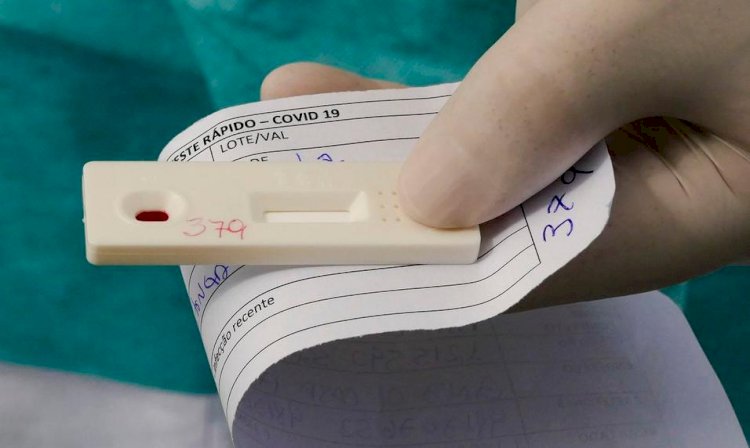 Em Goiás: Crianças e adolescentes podem fazer testes grátis para Covid