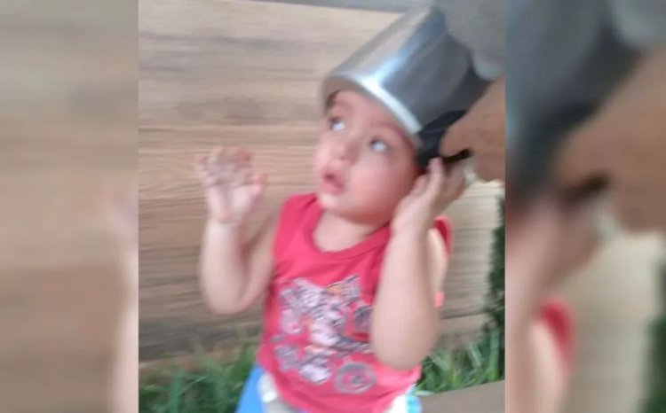 Em Goiás: Menino de 2 anos fica com a cabeça presa em panela de pressão