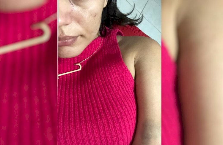 Empresária denuncia agressão de ex-namorado por recusa de empréstimo, em Jaraguá