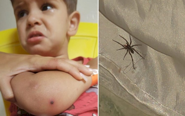 Em Goiás: Criança de 2 anos é internada após picada de aranha