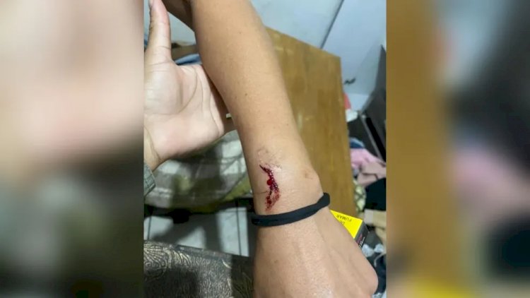 Homem é preso suspeito de agredir a ex com mordida e marteladas, em Jaraguá